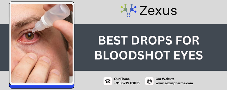 Best Drops for Bloodshot Eyes
